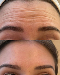 Solução de cuidados faciais hidratantes e rejuvenescedores da pele