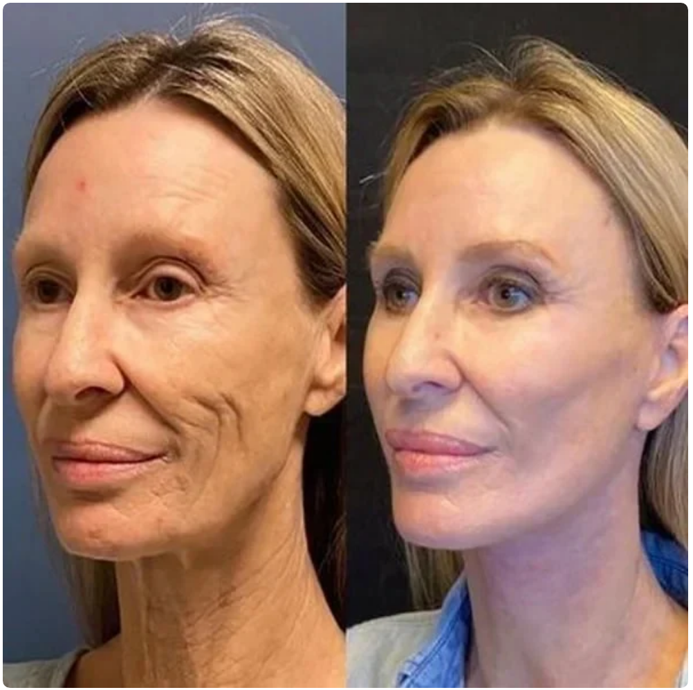 Solução de cuidados faciais hidratantes e rejuvenescedores da pele