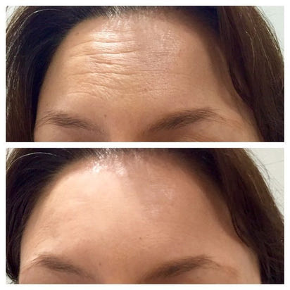 Solução de cuidados faciais hidratantes e rejuvenescedores da pele