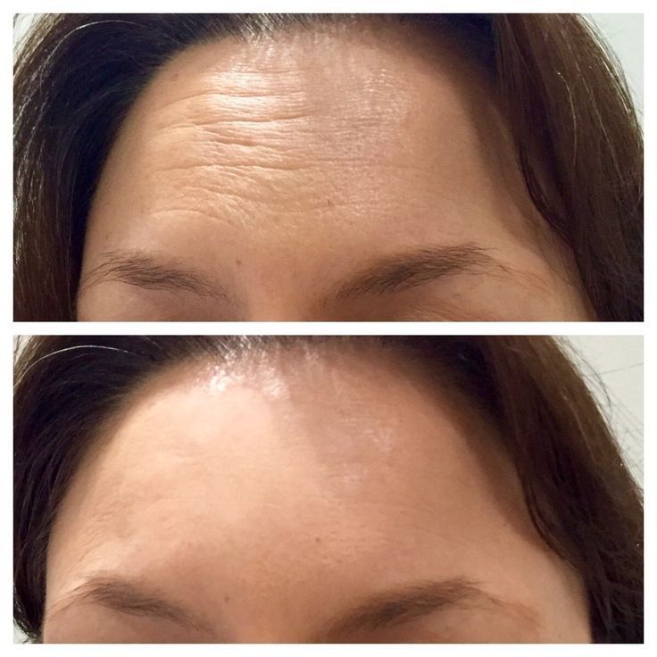 Solução de cuidados faciais hidratantes e rejuvenescedores da pele